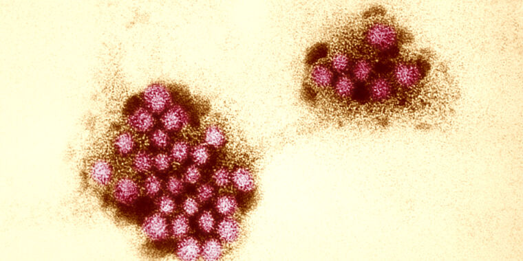 Norovirus Cases Rising, Could Exceed 2022’s Record