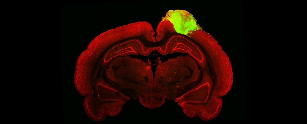 Rat Brain Human Organoid.jpg